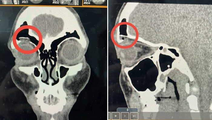 Rhea Ripley Reacts To X-Rays Of Her Injury, Cody Rhodes Asks Fans Who Should Be In WWE ID